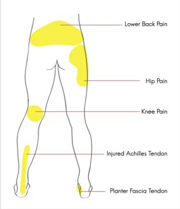 Sciatica Pain Treatment